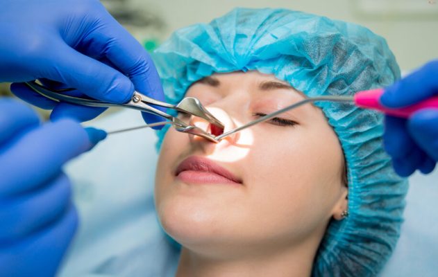 جراحی بینی به روش بسته